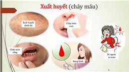 Bác sĩ chỉ rõ 2 biến chứng nguy hiểm của sốt xuất huyết, dấu hiệu cảnh báo cần đến viện ngay